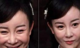 西安整容爆料事件视频播放,揭秘美容行业背后真相